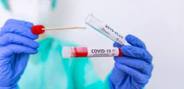 TAMPONE RAPIDO, TAMPONE MOLECOLARE E TEST SIEROLOGICO  IN FARMACIA SENZA PRENOTAZIONE